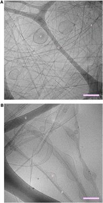 NACore Amyloid Formation in the Presence of Phospholipids
